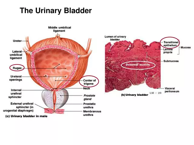 The connection between bladder and urinary incontinence symptoms and prostate health